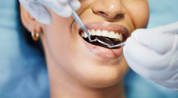 Best Emergency Wisdom Teeth Removal in Blackshear, GA